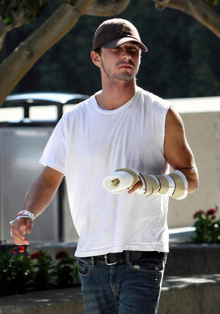 shia labeouf hand injury pictures. Tags: Shia LaBeouf